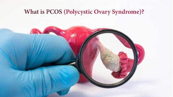What is PCOS (Polycystic Ovary Syndrome)
